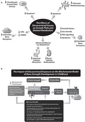 Glucocorticoid-Induced Osteoporosis: Why Kids Are Different